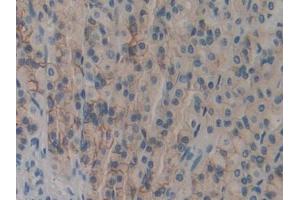 DAB staining on IHC-P; Samples: Rat Stomach Tissue (DOK7 Antikörper  (AA 63-320))