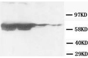 Western Blotting (WB) image for anti-Glial Fibrillary Acidic Protein (GFAP) antibody (ABIN1107345)