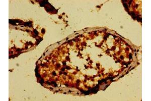 Immunohistochemistry of paraffin-embedded human testis tissue using ABIN7169116 at dilution of 1:100 (NEK9 Antikörper  (AA 821-979))