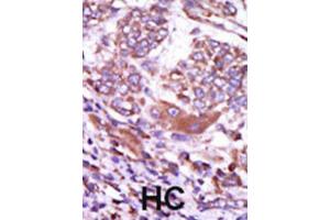Immunohistochemistry (IHC) image for anti-Calcium/calmodulin-Dependent Protein Kinase II delta (CAMK2D) antibody (ABIN5023065) (CAMK2D Antikörper)
