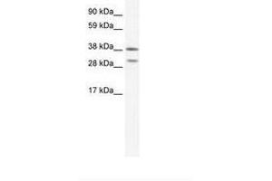Image no. 1 for anti-NK2 Homeobox 3 (NKX2-3) (AA 34-83) antibody (ABIN202180) (NK2 Homeobox 3 Antikörper  (AA 34-83))