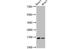 Western Blot Positive WB detected in: Rat heart tissue, Mouse heart tissue All lanes: C3orf14 antibody at 2. (C3ORF14 Antikörper  (AA 9-128))