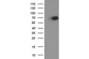 HEK293T cells were transfected with the pCMV6-ENTRY control (Left lane) or pCMV6-ENTRY OGFOD1 (Right lane) cDNA for 48 hrs and lysed. (OGFOD1 Antikörper)