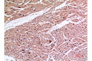Immunohistochemistry (IHC) analysis of paraffin-embedded Human Heart, antibody was diluted at 1:100. (XRCC6 Antikörper  (Ser402))