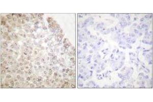 Immunohistochemistry (IHC) image for anti-Histone Deacetylase 5 (HDAC5) (AA 1073-1122) antibody (ABIN2889210) (HDAC5 Antikörper  (AA 1073-1122))