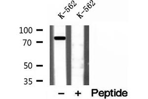 Western blot analysis of extracts of K-562 cells, using Coilin antibody. (Coilin Antikörper  (Internal Region))
