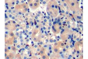 Detection of TAN1 in Mouse Kidney Tissue using Polyclonal Antibody to Translocation Associated Notch Homolog 1 (TAN1) (Notch1 Antikörper  (AA 1919-2079))