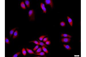 MCF-7 cells were stained with DLG1+3 Polyclonal Antibody, Unconjugated at 1:500 in PBS and incubated for two hours at 37°C followed by Goat Anti-Rabbit IgG (H+L) Cy3 conjugated secondary antibody. (DLG3 Antikörper  (AA 501-600))