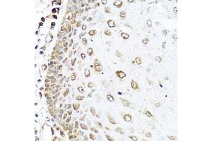 Immunohistochemistry of paraffin-embedded human esophagus using RAC2 antibody (ABIN5970487) at dilution of 1/100 (40x lens). (RAC2 Antikörper)