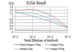 Black line: Control Antigen (100 ng),Purple line: Antigen (10 ng), Blue line: Antigen (50 ng), Red line:Antigen (100 ng) (IGLC2 Antikörper  (AA 1-106))