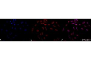 Immunocytochemistry/Immunofluorescence analysis using Mouse Anti-Hsp47 Monoclonal Antibody, Clone 1C4-1A6 . (SERPINH1 Antikörper  (Atto 594))