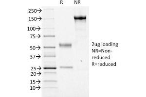SDS-PAGE Analysis Purified FOXA1 Mouse Monoclonal Antibody (FOXA1/1516). (FOXA1 Antikörper  (AA 372-472))