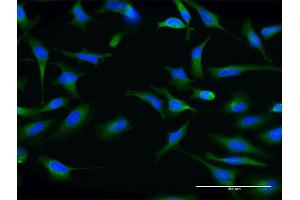 Immunofluorescence (IF) image for anti-ATP-Binding Cassette, Sub-Family G (WHITE), Member 1 (ABCG1) (AA 21-130) antibody (ABIN523112)