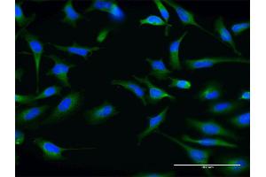 Immunofluorescence of monoclonal antibody to ABCG1 on HeLa cell. (ABCG1 Antikörper  (AA 21-130))