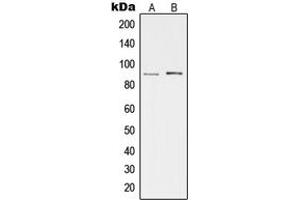 Western blot analysis of cGK 2 expression in HeLa (A), Hs67 (B) whole cell lysates. (PRKG2 Antikörper  (Center))