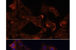 Immunofluorescence analysis of C6 cells using NRP1 Polyclonal Antibody at dilution of 1:100. (Neuropilin 1 Antikörper)