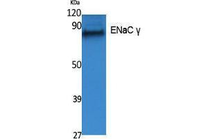 Western Blotting (WB) image for anti-Sodium Channel, Nonvoltage-Gated 1, gamma (SCNN1G) (Internal Region) antibody (ABIN3178066) (SCNN1G Antikörper  (Internal Region))