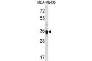 Western Blotting (WB) image for anti-Fibrinogen-Like 1 (FGL1) antibody (ABIN2996869) (FGL1 Antikörper)