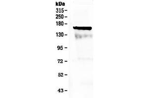 Western blot analysis of Flt3 / CD135 using anti-Flt3 / CD135 antibody .