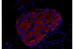 Immunohistochemistry (IHC) image for anti-Uncoating ATPase (AA 1-650) antibody (ABIN1742323) (Uncoating ATPase (AA 1-650) Antikörper)
