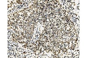 IHC analysis of RCC1 using anti-RCC1 antibody (ABIN7600024).