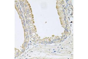 Immunohistochemistry of paraffin-embedded human prostate using ANKH antibody.