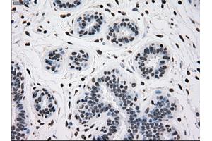 Immunohistochemical staining of paraffin-embedded breast tissue using anti-TYRO3 mouse monoclonal antibody. (TYRO3 Antikörper)
