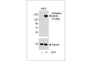 Western blot analysis of lysates from A431 cell line, untreated or treated with EGF, 100 ng/mL, using (ABIN389572 and ABIN2839598) (upper) or Tubulin (lower). (ERBB4 Antikörper  (pTyr1162))