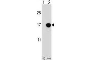 Western Blotting (WB) image for anti-Cyclin-Dependent Kinase Inhibitor 2B (p15, Inhibits CDK4) (CDKN2B) antibody (ABIN2996859) (CDKN2B Antikörper)