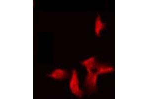ABIN6275300 staining Hela by IF/ICC. (NBPF5 Antikörper)