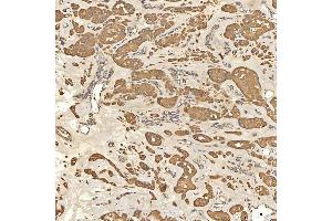IHC analysis of Citrin/SLC25A13 using anti-Citrin/SLC25A13 antibody (ABIN7599512). (slc25a13 Antikörper  (AA 1-643))