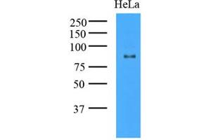 Western Blotting (WB) image for anti-K(lysine) Acetyltransferase 2A (KAT2A) (AA 411-837) antibody (ABIN487349) (KAT2A Antikörper  (AA 411-837))