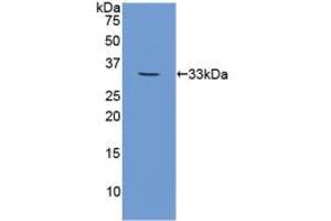Western blot analysis of recombinant Human CAPN1. (CAPNL1 Antikörper  (AA 75-343))