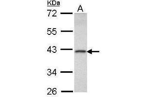 WB Image Sample (30 ug of whole cell lysate) A: Raji 10% SDS PAGE antibody diluted at 1:1000 (DEDD Antikörper)