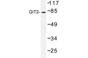 Image no. 1 for anti-G Protein-Coupled Receptor Kinase Interactor 2 (GIT2) antibody (ABIN272229) (GIT2 Antikörper)