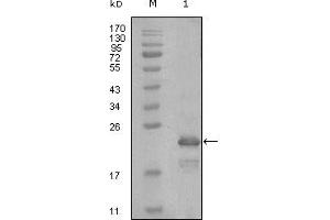 Western blot analysis using HAND1 mouse mAb against truncated Trx-HAND1 recombinant protein (1). (HAND1 Antikörper)