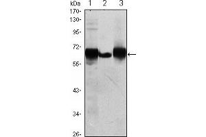 Western blot analysis using ALPP mouse mAb against HepG2 (1), A431 (2) and MCF-7 (3) cell lysate. (PLAP Antikörper)