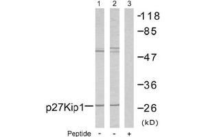 Image no. 2 for anti-Cyclin-Dependent Kinase Inhibitor 1B (p27, Kip1) (CDKN1B) (Ser10) antibody (ABIN197351) (CDKN1B Antikörper  (Ser10))