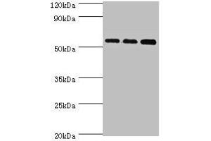 Western blot All lanes: Acyl-coenzyme A synthetase ACSM3, mitochondrial antibody at 10 μg/mL Lane 1: 293T whole cell lysate Lane 2: Mouse kidney tissue Lane 3: A431 whole cell lysate Secondary Goat polyclonal to rabbit IgG at 1/10000 dilution Predicted band size: 67, 50 kDa Observed band size: 67 kDa (ACSM3 Antikörper  (AA 387-586))