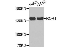 Western blot analysis of extracts of various cell lines, using ROR1 antibody. (ROR1 Antikörper  (AA 30-200))