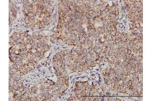 Image no. 1 for anti-Protoporphyrinogen Oxidase (PPOX) (AA 378-478) antibody (ABIN598883) (PPOX Antikörper  (AA 378-478))