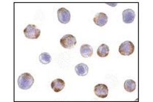 Image no. 3 for anti-Nucleotide-Binding Oligomerization Domain Containing 2 (NOD2) (C-Term) antibody (ABIN372922) (NOD2 Antikörper  (C-Term))
