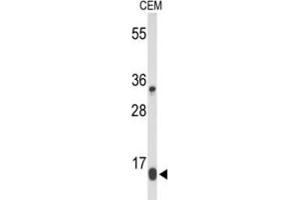 Western Blotting (WB) image for anti-DIRAS Family, GTP-Binding RAS-Like 1 (DIRAS1) antibody (ABIN3004163) (DIRAS1 Antikörper)
