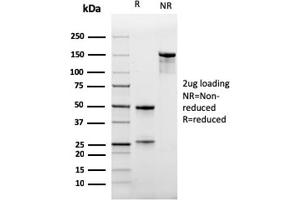 SDS-PAGE Analysis Purified CD47 Mouse Monoclonal Antibody (IAP/964). (CD47 Antikörper)