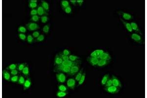 Immunofluorescent analysis of PC-3 cells using ABIN7176539 at dilution of 1:100 and Alexa Fluor 488-congugated AffiniPure Goat Anti-Rabbit IgG(H+L) (Zinc Finger Protein 816A (ZNF816A) (AA 1-200) Antikörper)