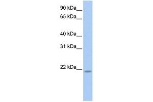 WB Suggested Anti-RNF5 Antibody Titration: 0.