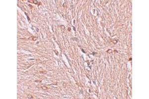 Immunohistochemistry (IHC) image for anti-Zinc Finger and BTB Domain Containing 4 (ZBTB4) (C-Term) antibody (ABIN1030812) (ZBTB4 Antikörper  (C-Term))