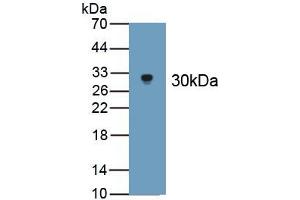 Detection of Recombinant APOB100, Cattle using Polyclonal Antibody to Apolipoprotein B100 (APOB100) (Apo-B100 Antikörper  (AA 4331-4567))