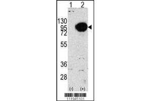 Western blot analysis of PYGM using rabbit polyclonal PYGM Antibody using 293 cell lysates (2 ug/lane) either nontransfected (Lane 1) or transiently transfected with the PYGM gene (Lane 2). (PYGM Antikörper  (C-Term))