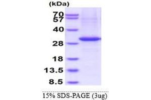 SDS-PAGE (SDS) image for Kallikrein-Related Peptidase 15 (KLK15) (AA 22-256) protein (His tag) (ABIN5853543) (Kallikrein 15 Protein (AA 22-256) (His tag))